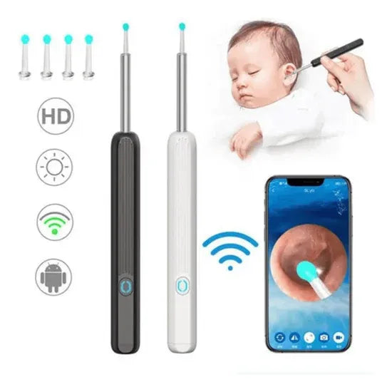 EarWax®: Limpieza de Oídos en Alta Definición