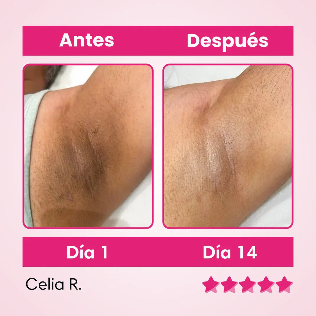 Crema Aclarante De Zonas Oscuras: Puedes usarlo en axilas, cuello, zona íntima, codos y rodillas. ¡Lleva Gratis un Tratamiento Capilar!