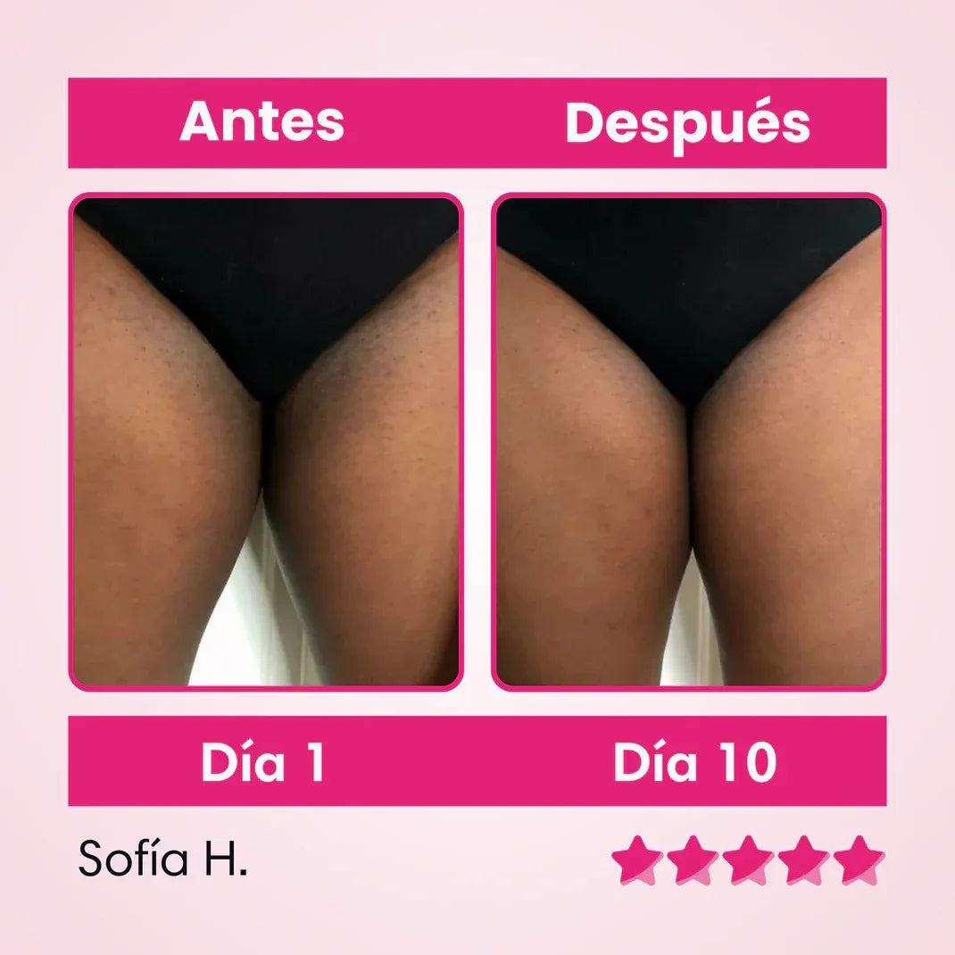 Crema Aclarante De Zonas Oscuras: Puedes usarlo en axilas, cuello, zona íntima, codos y rodillas. ¡Lleva Gratis un Tratamiento Capilar!