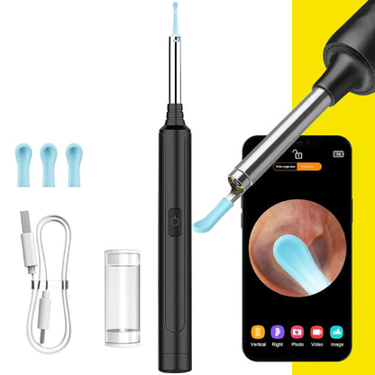 EarWax®: Limpieza de Oídos en Alta Definición