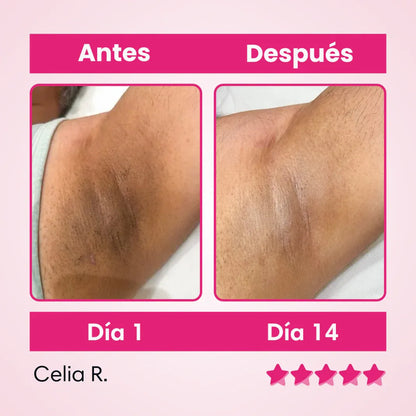 Crema Aclarante De Zonas Oscuras: Puedes usarlo en axilas, cuello, zona íntima, codos y rodillas. ¡Lleva Gratis un Tratamiento Capilar!
