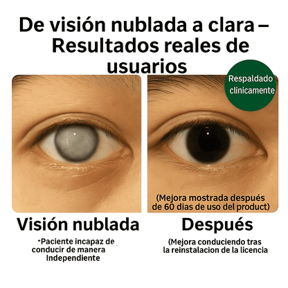 Zooone Vision Care™ – Vitaminas y Minerales para tus Ojos 👁️✨
