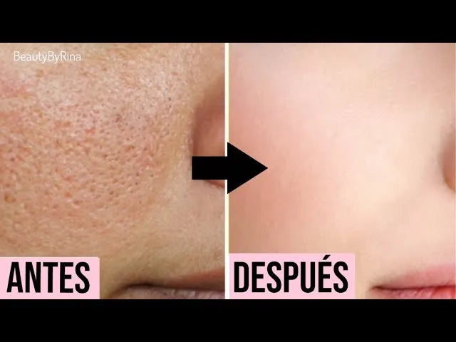 2X1 Sérum Facial SADOER® Acido Lactobionico Reducción de Poros